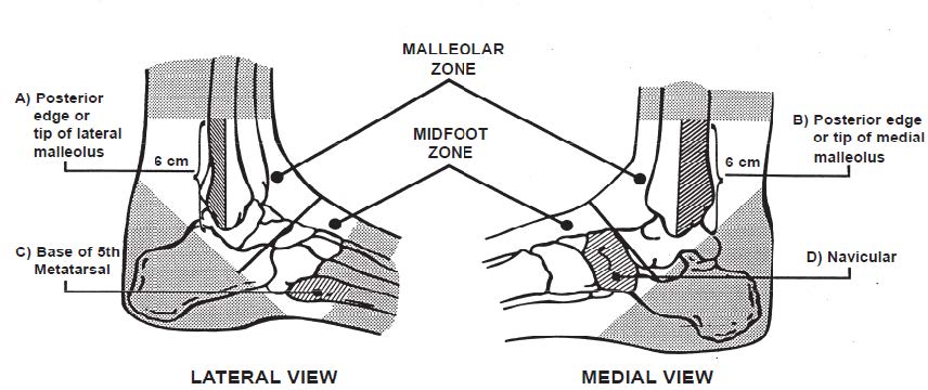 An image shows an illustrated lateral view and media view of ankle and part of foot pointing to different areas