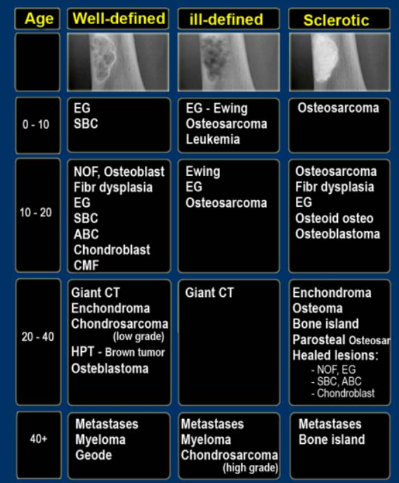 A table from a study guide shows bone lesion imaging for well-defined, ill-definded and sclerotic, with columns below for age ranges and different morphologies.